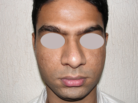 Dr Pandya Clinic Udaipur